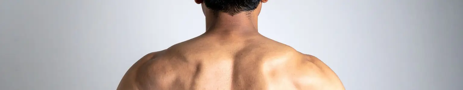 testosterone-therapy-and-acne